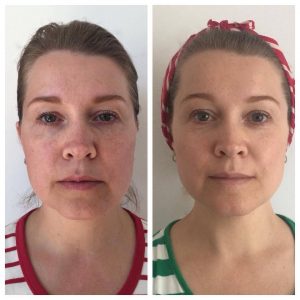Before and after 9 Before and after
