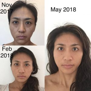 FACIAL YOGA BEFORE AND AFTER