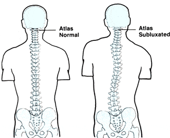 De Atlas, C1 ofwel onze eerste halswervel 5 De Atlas, C1 ofwel onze eerste halswervel 4