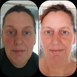 FACIAL YOGA BEFORE AND AFTER