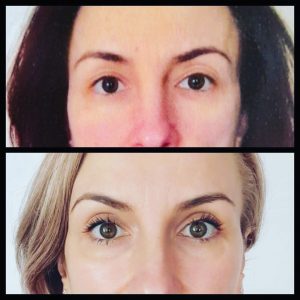 Before and after face yoga