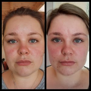 Before and after face yoga