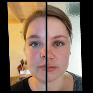 Before and after face yoga