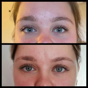 Before and after 18 Before and after eyes